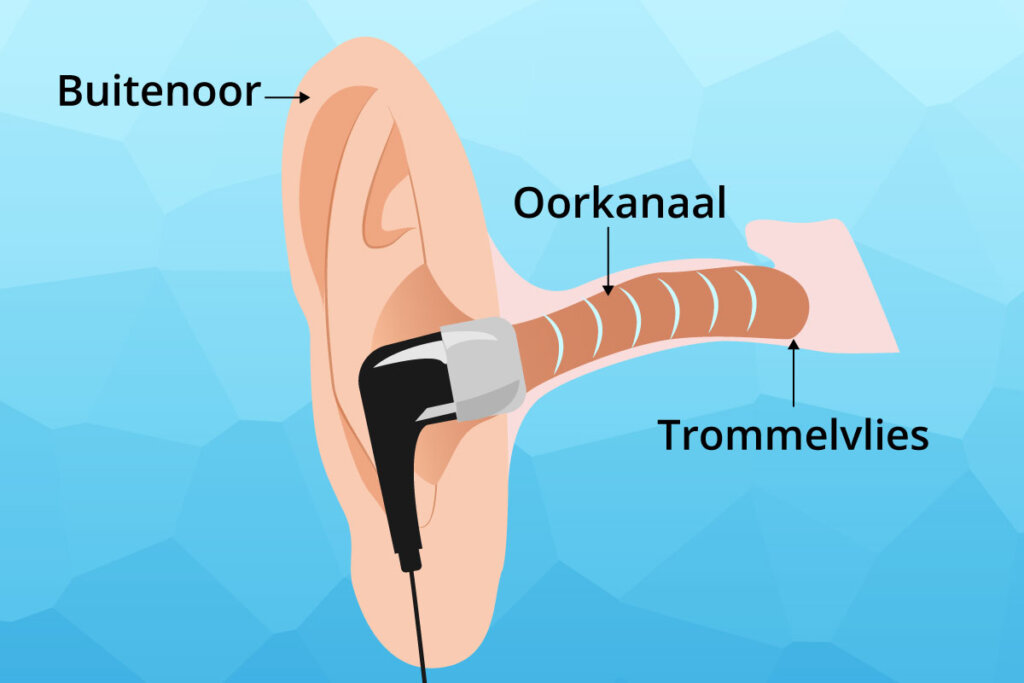 placement_diagram